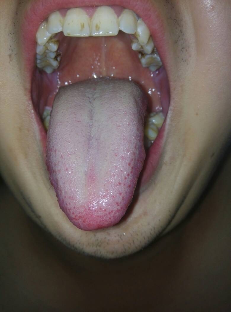 七嘴八舌是指什么生肖?谜底即将揭晓