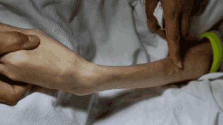 骨瘦如柴代表打一正确生肖，全面揭晓解释落实