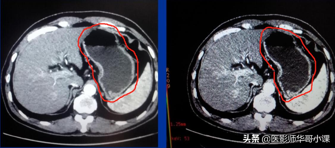 年幼无知猜一生肖，定量分析揭示的智慧