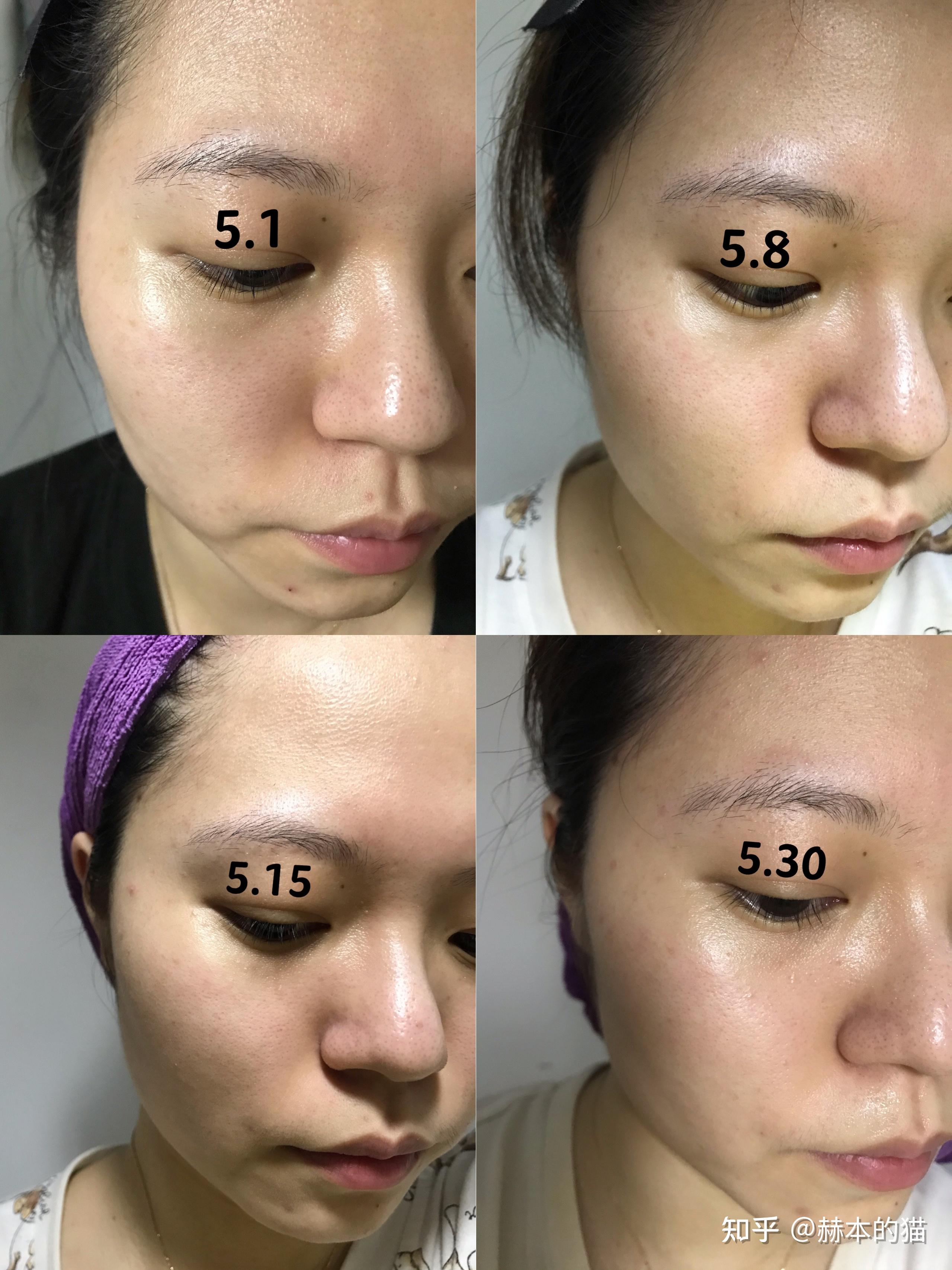 鼻蹋嘴歪打一生肖，友爱作答落实解释